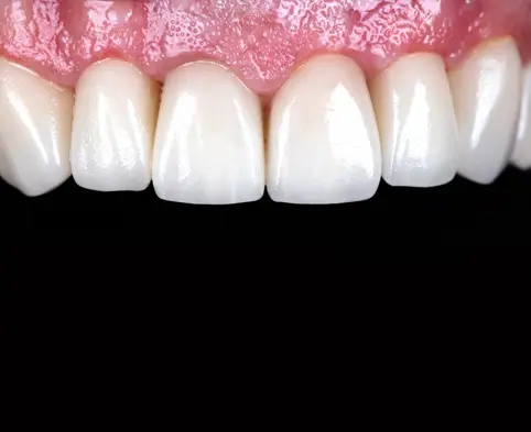 thumb1 procedures