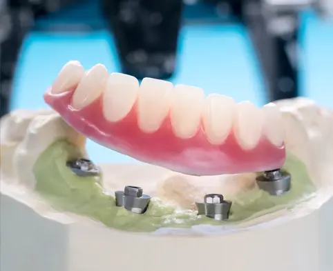 thumb1 procedures
