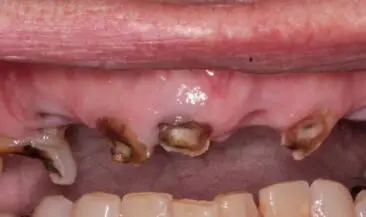 Before - Al Daadaa